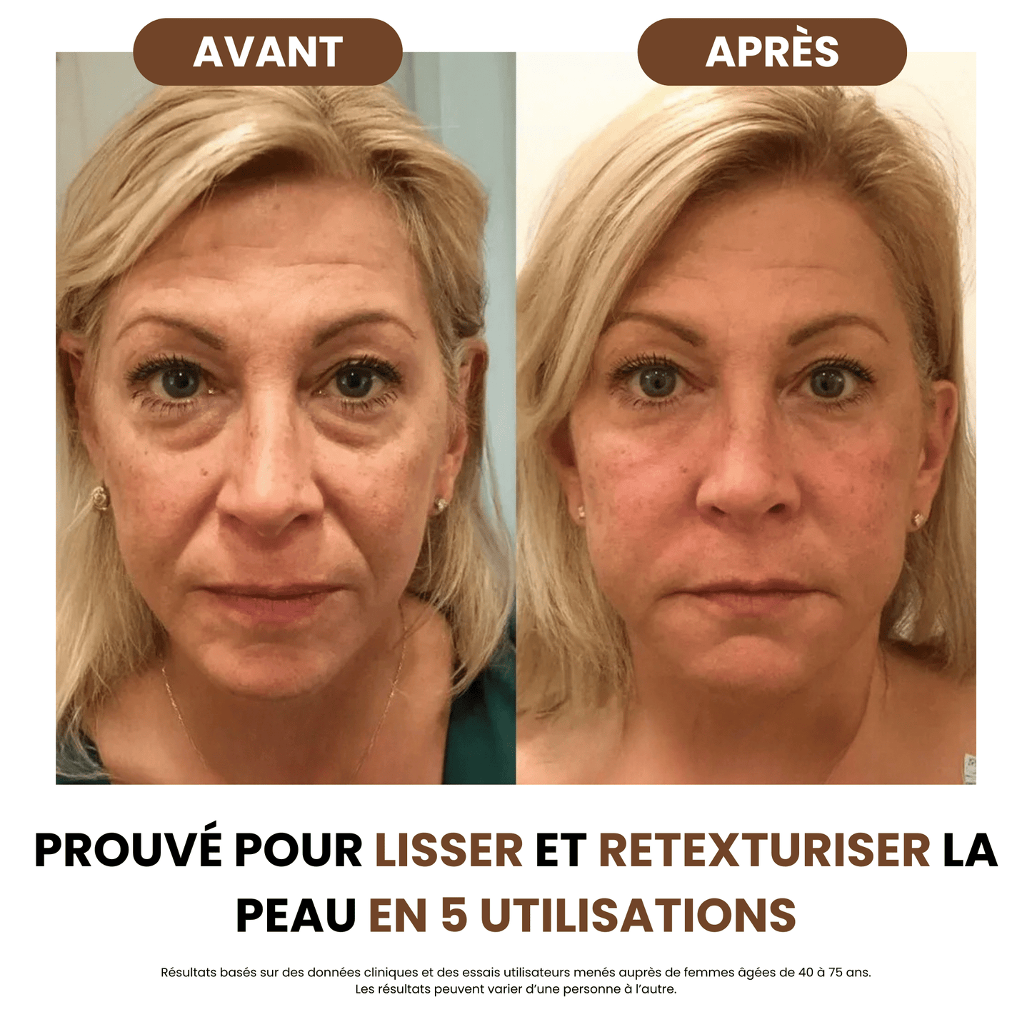 Brosse de drainage lymphatique - Body Sunday