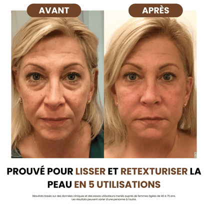 Brosse de drainage lymphatique - Body Sunday