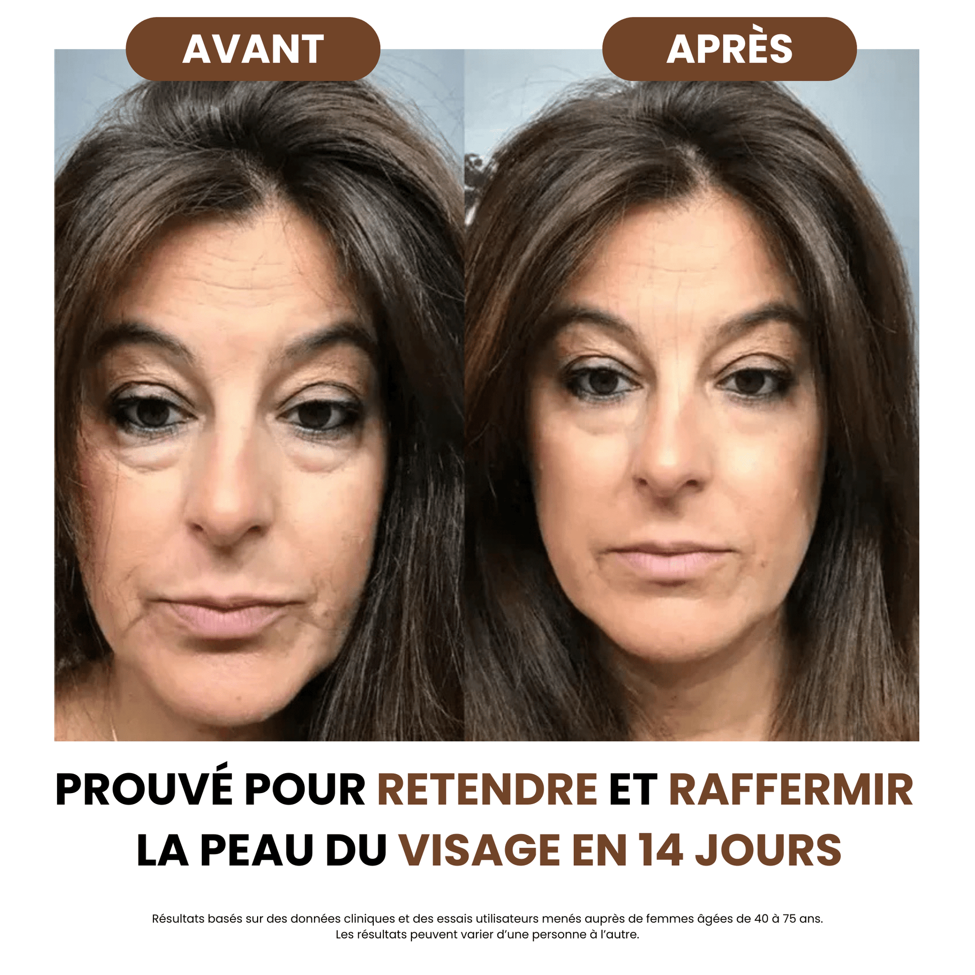Brosse de drainage lymphatique - Body Sunday
