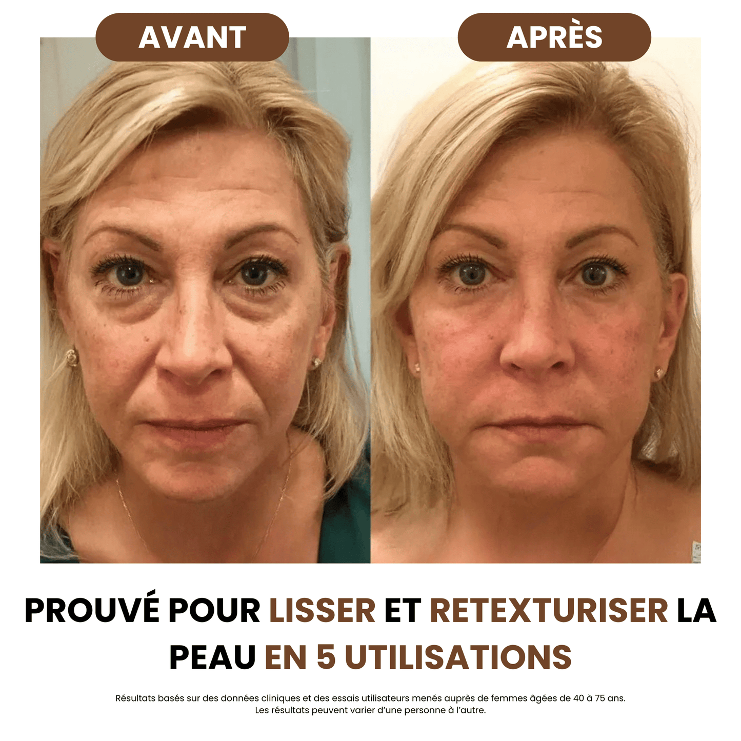 Brosse lymphatique - Body Sunday