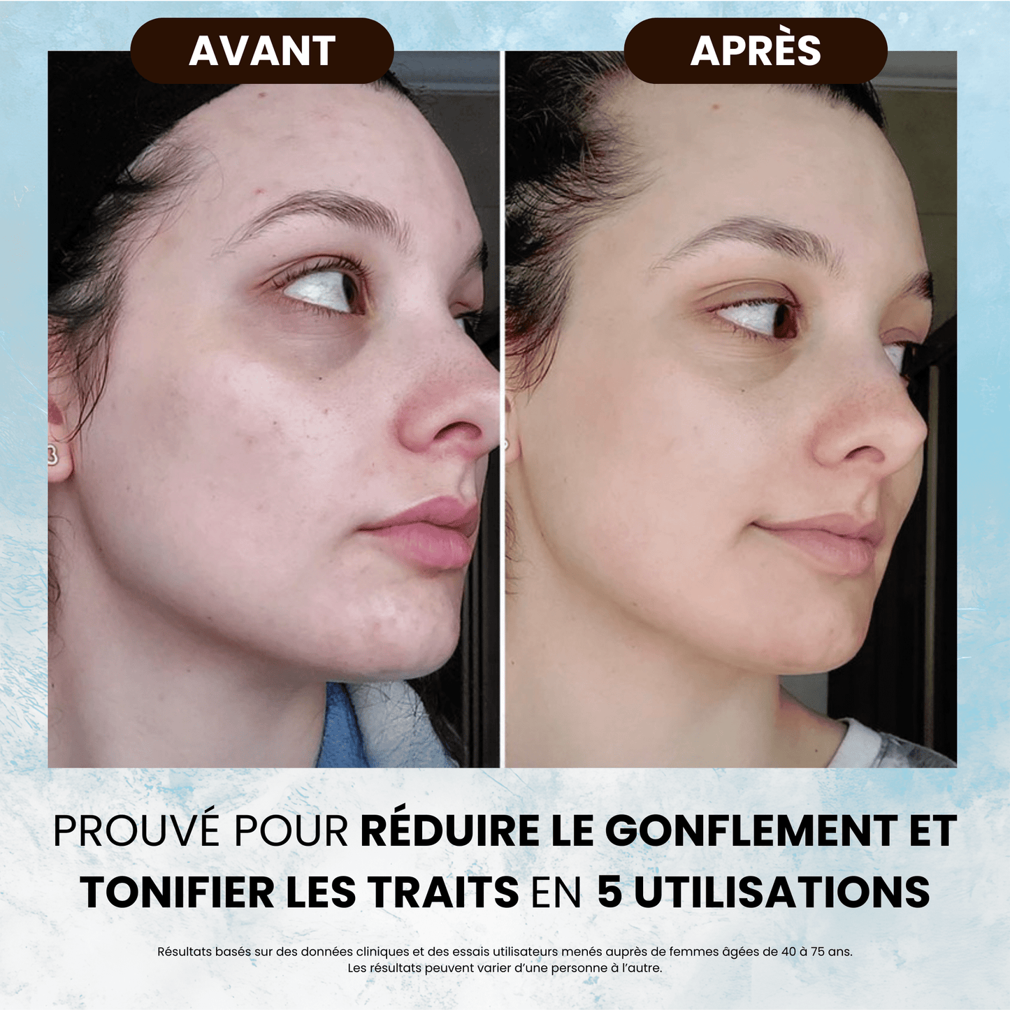 Contour givré - Body Sunday